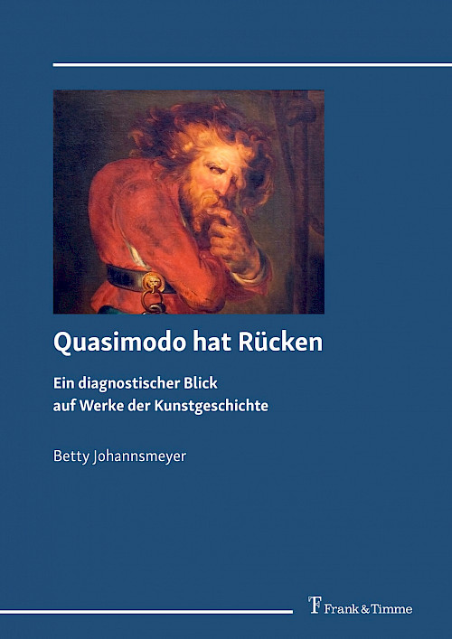 Quasimodo hat Rücken